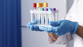 Как учесть расходы на тестирование работников на коронавирус: разъяснения ФНС и Минфина