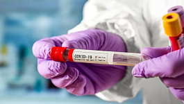 Водителю компенсируют затраты на тестирование на коронавирус: что с НДС? 