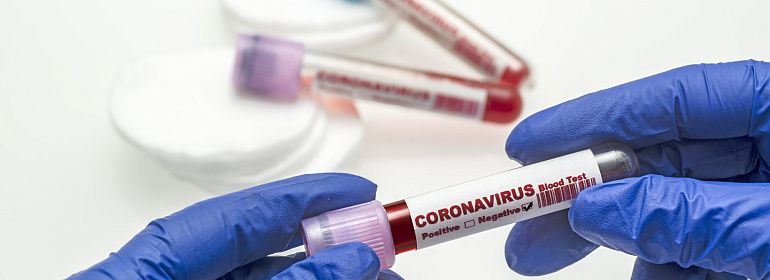 Платить ли страховые взносы при тестировании работников на коронавирус?